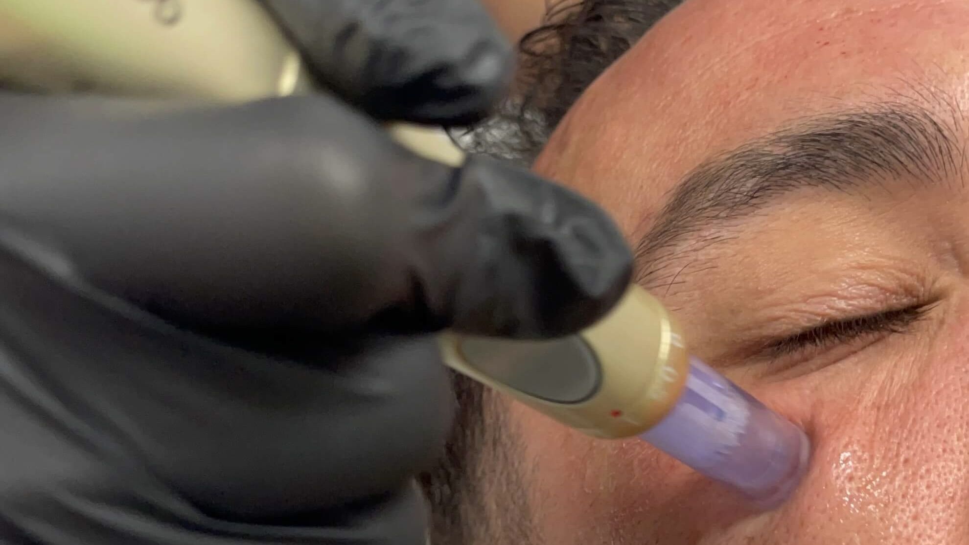 Tratamiento facial
