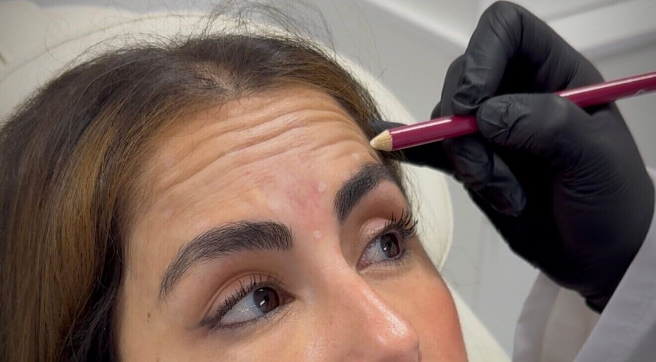 botox santander
